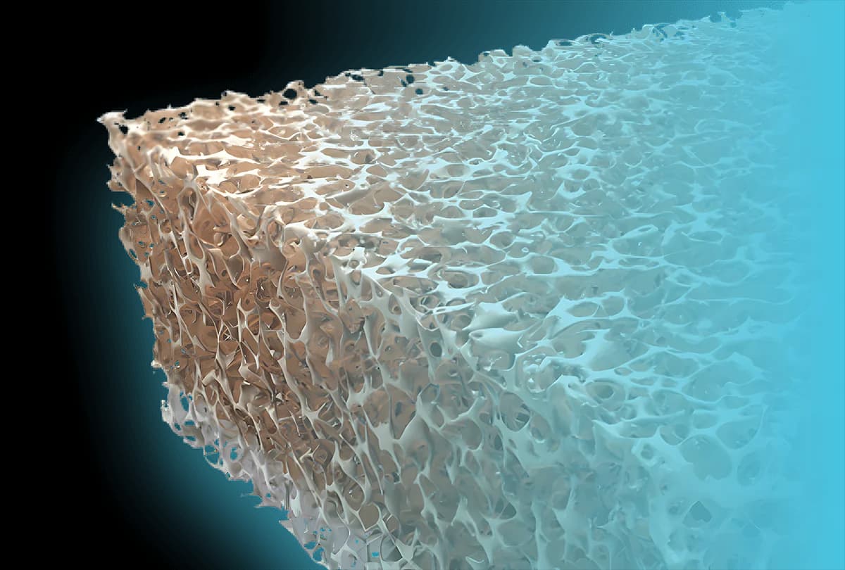 BioEnthesis Interpositional Biphasic Cancellous Allograft (left top corner)