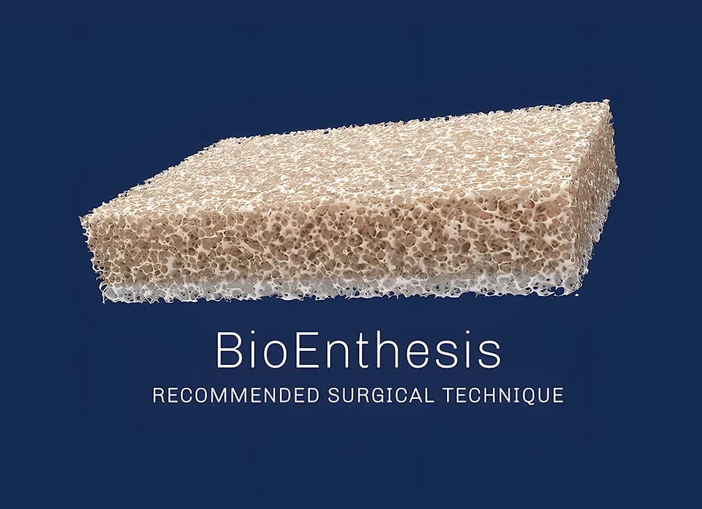 Recommended surgical technique animation