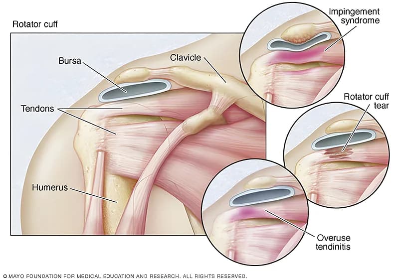Figure 1 illustration