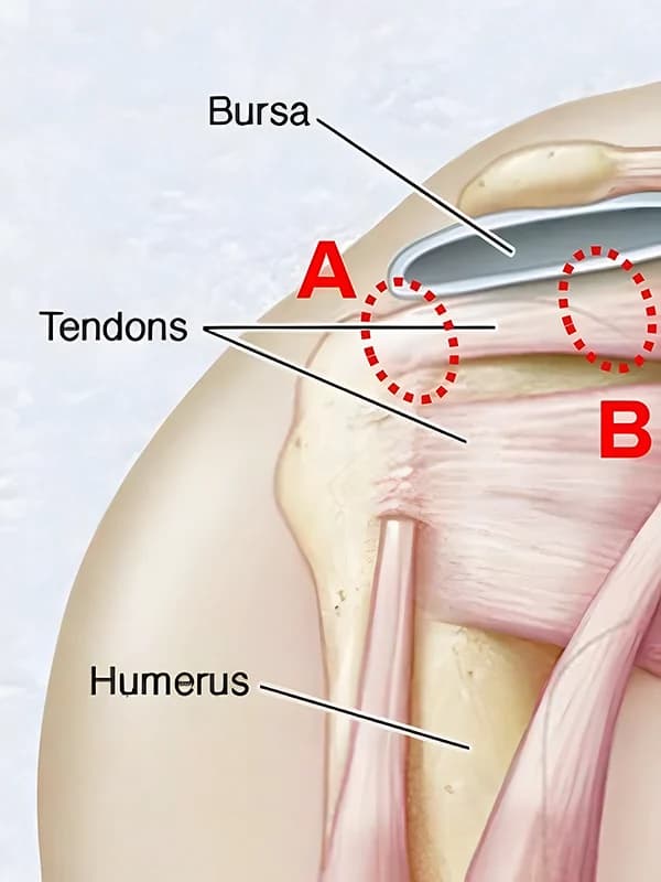 Figure 2 illustration